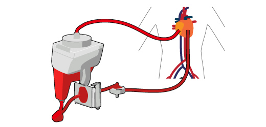 広島プラスチック_加工01